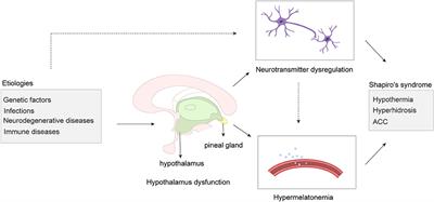 Frontiers A new perspective of hypothalamic disease: Shapiro's syndrome